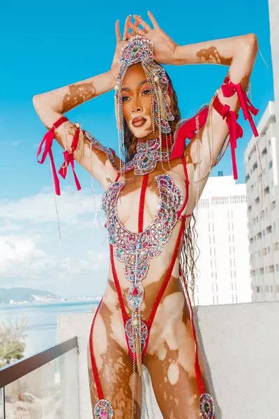 Winnie Harlow – miniatura