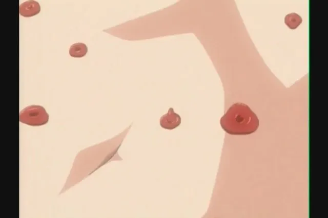 Kink 