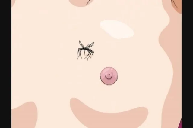 Kink 